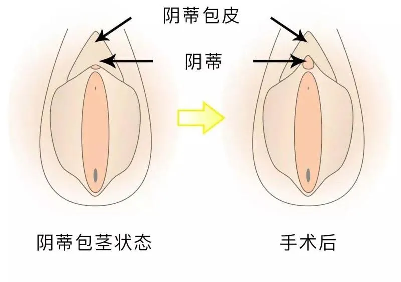 做了眼袋手术你后悔吗？眼袋手术后想看到好的效果，10年以上整形经验的整形医生怎么说