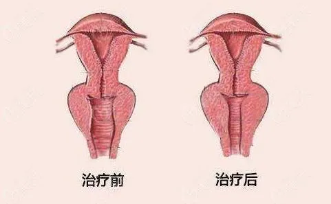 北京大学整形外科教授张宗学个人简介